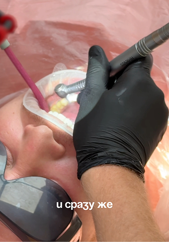 Чем опасен зубной камень